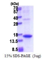 Human Angiogenin / ANG Protein (Recombinant His)
