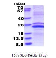Human MMP23 Protein (Recombinant His)