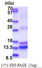 Human CASP2 / Caspase 2 Protein (Recombinant His)