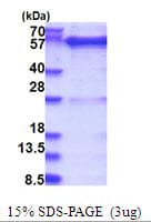 Human GDI1 Protein (Recombinant His)