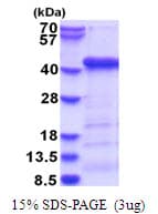 Human ATG3 Protein (Recombinant His)