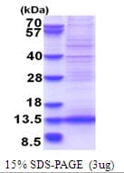 Human AF1Q / MLLT11 Protein (Recombinant His)