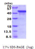 Human ACPP / PAP Protein (Recombinant His)