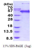 Human PEPD / PROLIDASE Protein (Recombinant His)