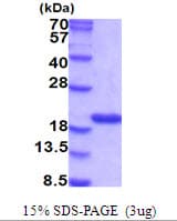 Human PPIA / Cyclophilin A Protein (Recombinant His)