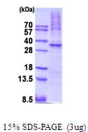 Human PRKAA1 / AMPK Alpha 1 Protein (Recombinant His)