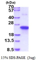 Human TIMP1 Protein (Recombinant His)