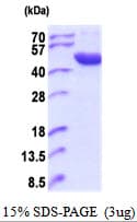 Human ACP6 Protein (Recombinant His)