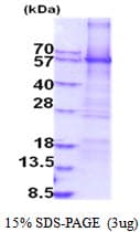 Human MAOA / Monoamine Oxidase Protein (Recombinant His)