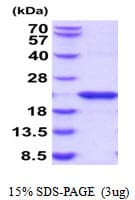 Human SHH / Sonic Hedgehog Protein (Recombinant)