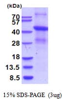 Human MSR1 / CD204 Protein (Recombinant His)