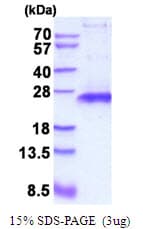Human TIMP1 Protein (Recombinant His)