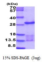 Human UBE2E3 Protein (Recombinant His)