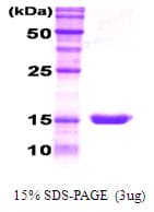Human CSF3 / G-CSF Protein (Recombinant)