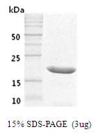 Human GH / Growth Hormone Protein (Recombinant)