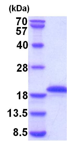 Human GH / Growth Hormone Protein (Recombinant)