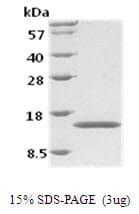 Human CSF2 / GM-CSF Protein (Recombinant)