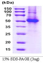 Human OPG / Osteoprotegerin Protein (Recombinant His)