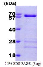 Human SMAD4 Protein (Recombinant His)