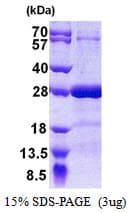 Human SNAP25 Protein (Recombinant His)