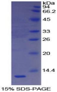 Human VTN / Vitronectin Protein (Recombinant His)