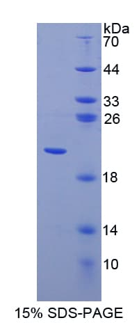 Human CD8A / CD8 Alpha Protein (Recombinant His)