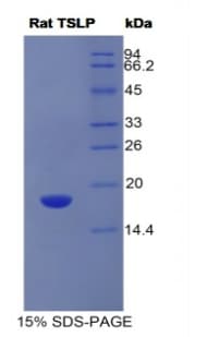 Human IFNAR1 / IFNAR Protein (Recombinant His)