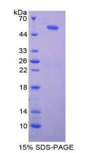 Human PTEN Protein (Recombinant 6His, N-terminus)