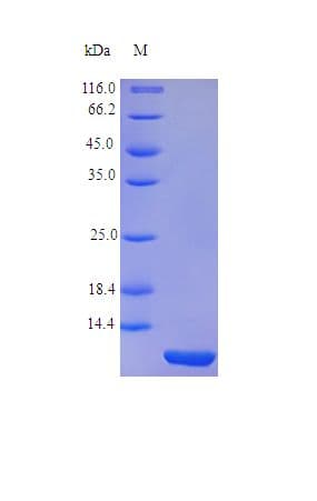 Human TFF1 / pS2 Protein (Recombinant)