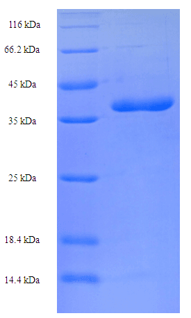 Human BCL2L11 / BIM Protein (Recombinant His-SUMO)