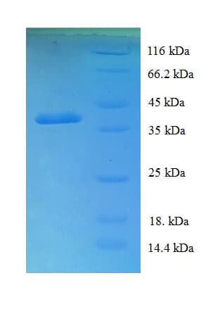 Human COA1 Protein (Recombinant GST)