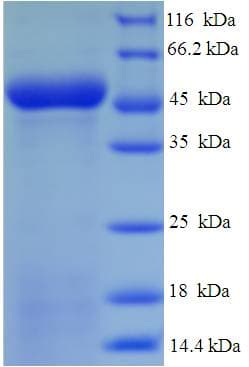 Human CD1D Protein (Recombinant His-SUMO)