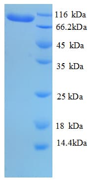 Human EEF2 / Elongation Factor 2 Protein (Recombinant 6His, N-terminus)