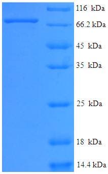 Human EYA2 Protein (Recombinant His-SUMO)