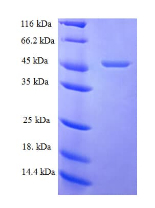 Human FGF10 Protein (Recombinant GST)
