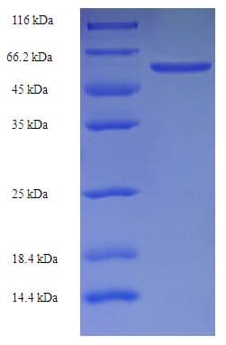 Rat LHCGR / LHR / LH Receptor Protein (Recombinant His-SUMO)