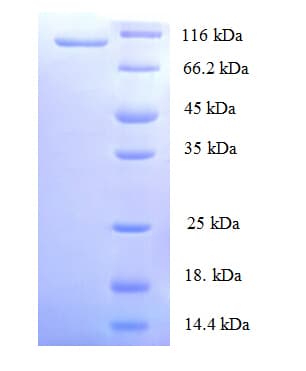 Human MCM2 Protein (Recombinant His)
