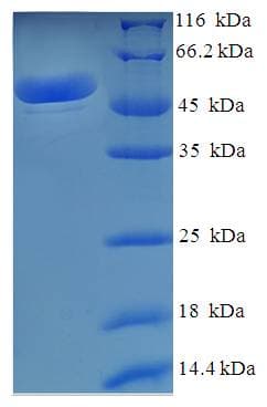 Human MDH / MDH2 Protein (Recombinant His-SUMO)