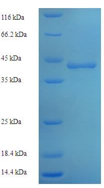 Human POLR3A Protein (Recombinant 6His-SUMO, N-terminus)