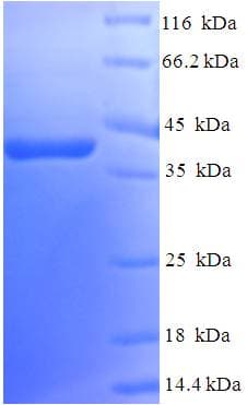 Human RAB5A / RAB5 Protein (Recombinant His-SUMO)