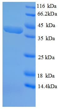 Human SPEG Protein (Recombinant GST)