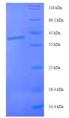 Human STX10 / Syntaxin 10 Protein (Recombinant His-SUMO)