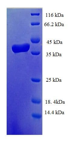 Human TCEB1 / Elongin C Protein (Recombinant GST)
