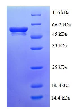 E. coli AlaC Protein (Recombinant His-SUMO)