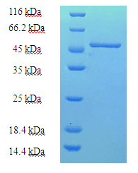 Human PNP / Nucleoside Phosphorylase Protein (Recombinant His-SUMO)