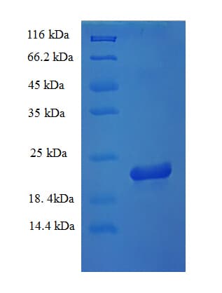 Rat IL18 Protein (Recombinant His)