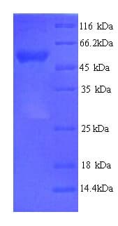 Human AP50 / AP2M1 Protein (Recombinant His)