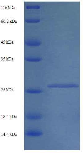 Mouse IFNAR2 Protein (Recombinant His)