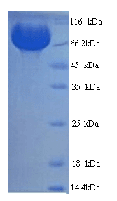 Human MME / CD10 Protein (Recombinant His)