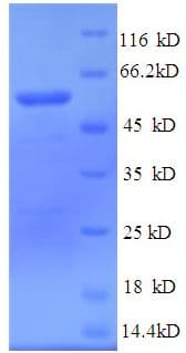 Human PLTP Protein (Recombinant His)